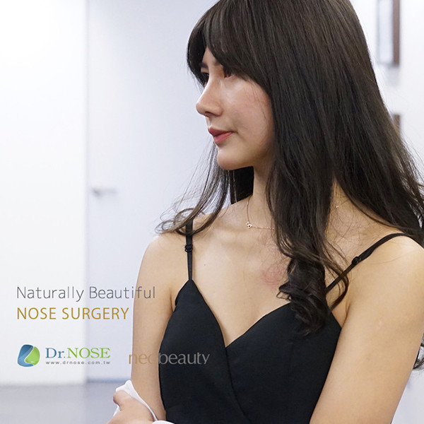 隆鼻手術、縮鼻翼手術合併下巴延長手術
